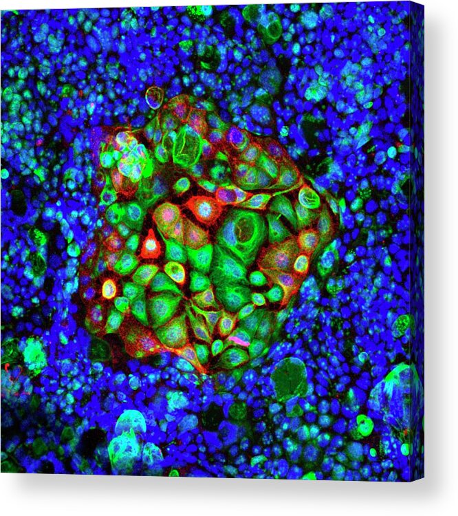 Cell Acrylic Print featuring the photograph Colorectal Cancer Cells by Ammrf, University Of Sydney