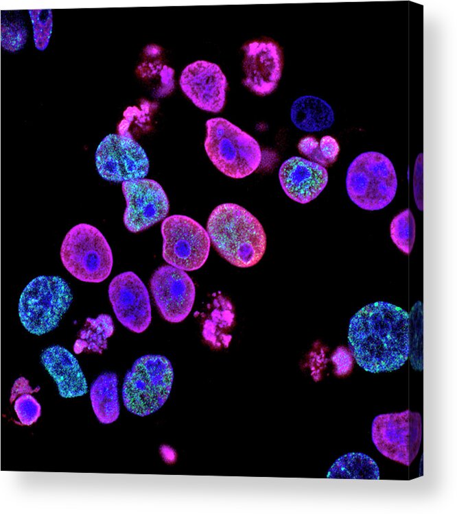 Cell Acrylic Print featuring the photograph Colorectal Cancer Treatment Research by Nci Center For Cancer Research/national Cancer Institute/science Photo Library