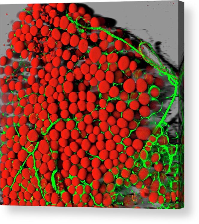 Nobody Acrylic Print featuring the photograph Fat Cells by National Institutes Of Health
