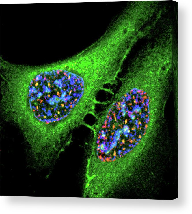 Cell Acrylic Print featuring the photograph Osteosarcoma Cells by Nci Center For Cancer Research/national Cancer Institute/science Photo Library