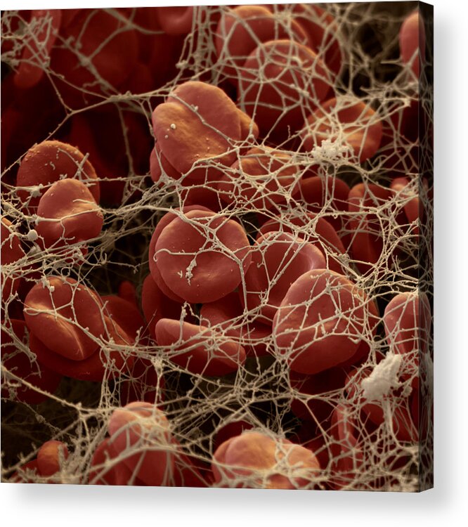 Blood Acrylic Print featuring the photograph Blood Clot #1 by Oliver Meckes EYE OF SCIENCE