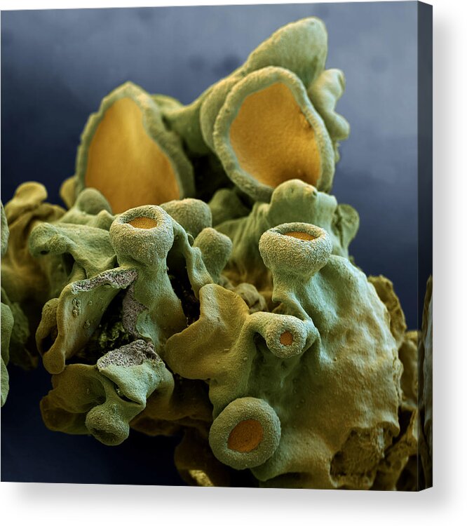 Algae Acrylic Print featuring the photograph Common Orange Lichen by Meckes/ottawa