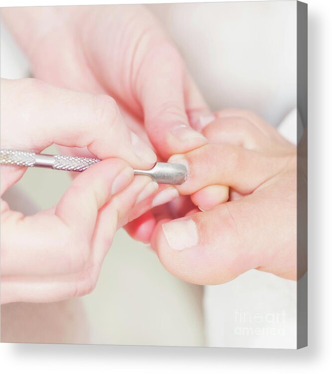 Pedicure Acrylic Print featuring the photograph Woman Having Pedicure #11 by Microgen Images/science Photo Library