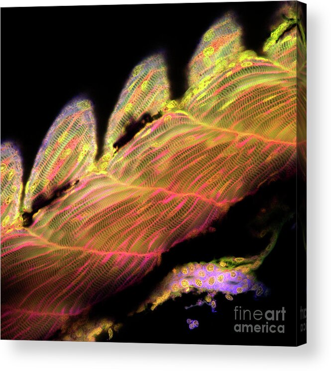 Zebrafish Acrylic Print featuring the photograph Zebrafish Muscle #5 by Stefanie Reichelt/science Photo Library