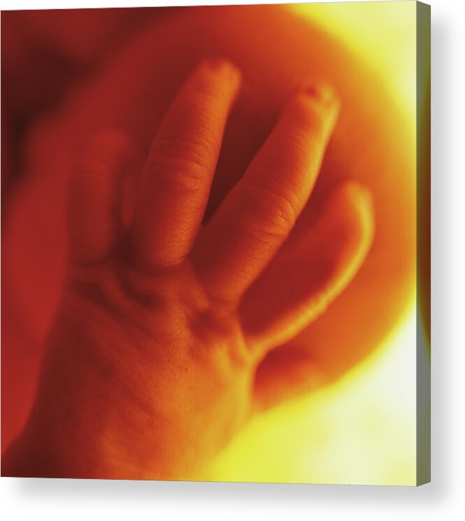 Colour Acrylic Print featuring the photograph Womb Series #1 by Anne Geddes