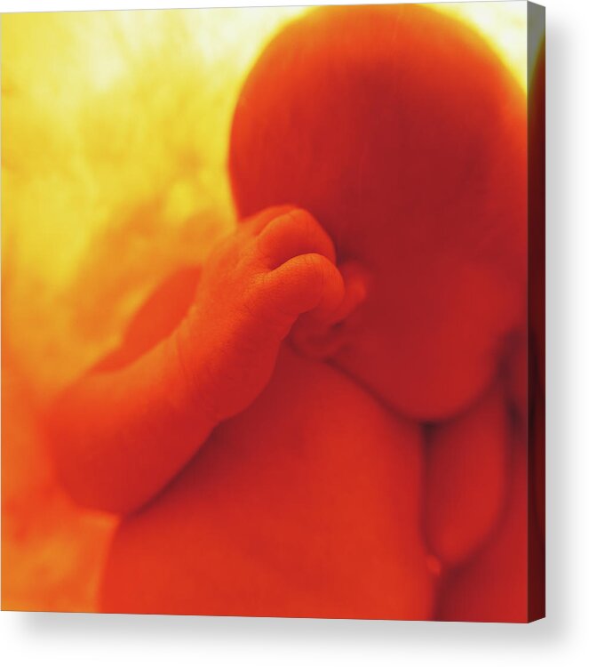 Color Acrylic Print featuring the photograph Womb Series #10 by Anne Geddes