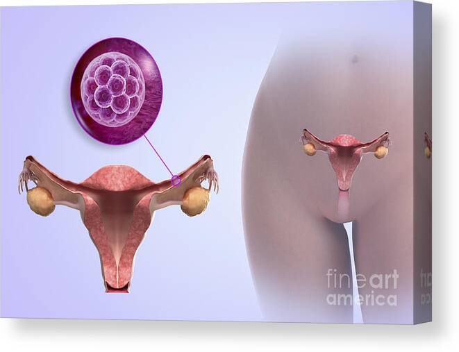 Embryogenesis Canvas Print featuring the photograph Morula In Fallopian Tube #1 by Science Picture Co