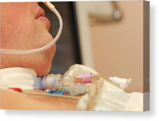 Tracheostomy Tube Canvas Print featuring the photograph Intensive Care Patient #2 by Bodenham, Lth Nhs Trust/science Photo Library