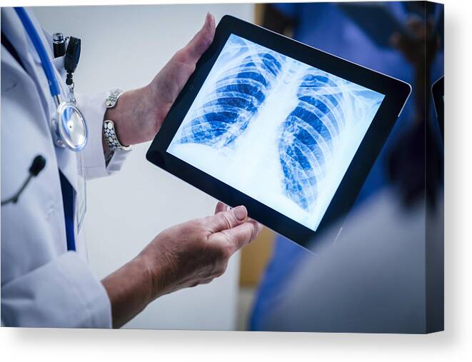 Expertise Canvas Print featuring the photograph Doctors examining x-ray of chest and ribs on digital tablet by FS Productions