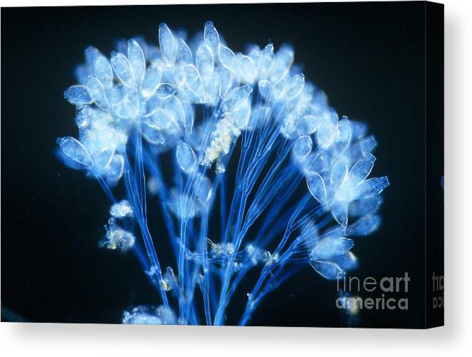 Microorganism Canvas Print featuring the photograph Epistylis by Michael Abbey