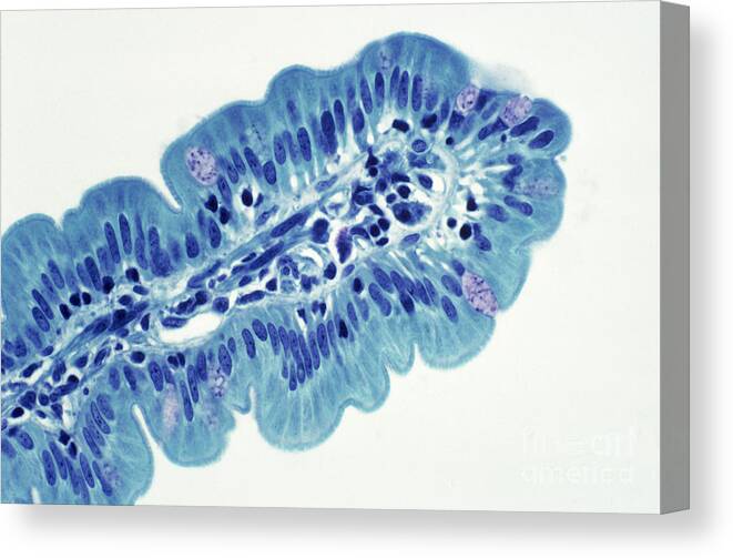Histology Canvas Print featuring the photograph Intestinal Villi Lm by Dr. Cecil H. Fox