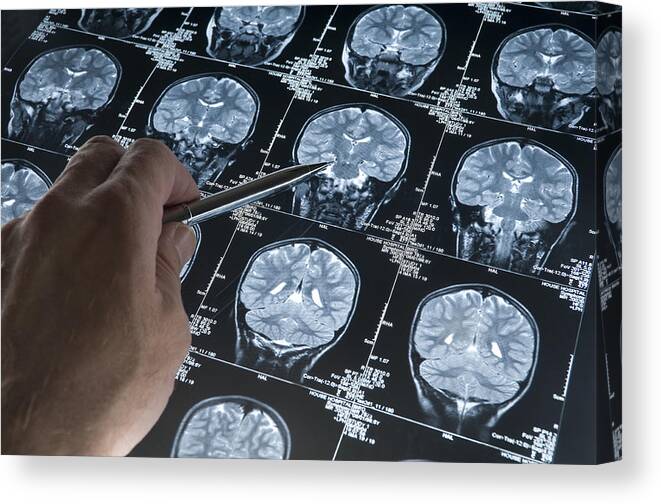 Wired Canvas Print featuring the photograph MRI Brain Scan of head and skull with hand pointing by Haydenbird