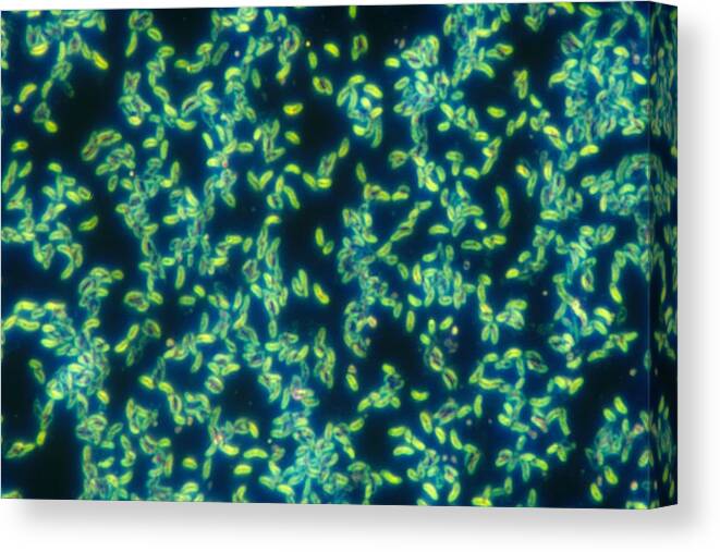 Bacteria Canvas Print featuring the photograph Vibrio Cholerae, Lm by Michael Abbey