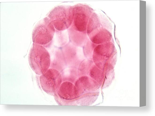 Starfish Canvas Print featuring the photograph Starfish Embryo #8 by Science Source