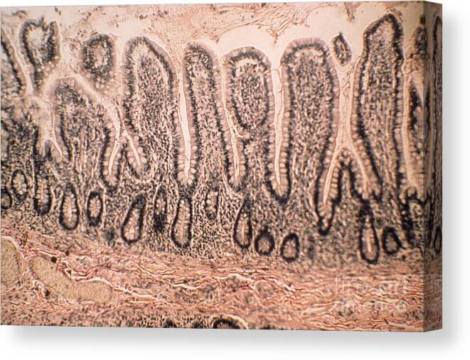 Histology Canvas Print featuring the photograph Intestinal Villi Lm by Eric V. Grave