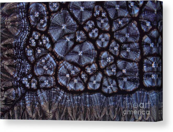 Atherosclerosis Canvas Print featuring the photograph Cholesterol Crystals, Polarized Lm #3 by Antonio Romero