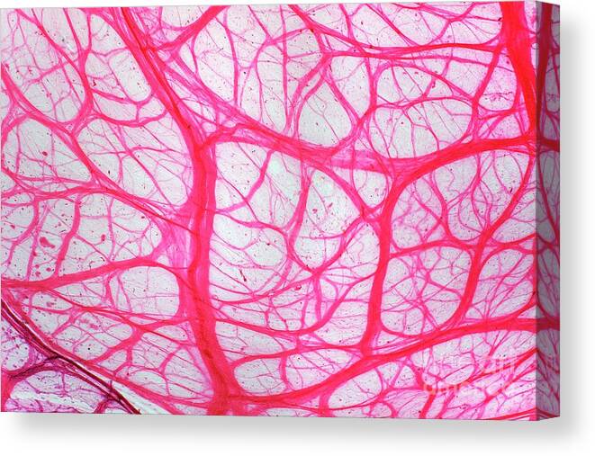Tissue Canvas Print featuring the photograph Bladder Tissue by Dr Keith Wheeler/science Photo Library