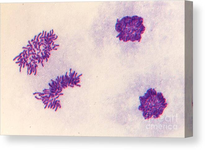Anaphase Canvas Print featuring the photograph Mitosis #10 by Dr. Juan F. Gimenez-abian / Science Photo Library