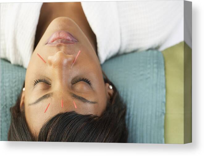 Tranquility Canvas Print featuring the photograph Acupuncture needles in African woman's face by Jon Feingersh Photography Inc
