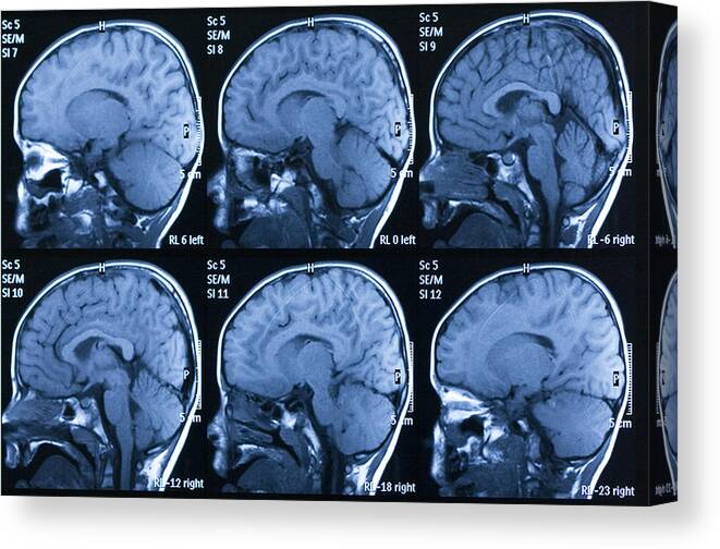 Tomography Canvas Print featuring the photograph MRI scan of brain by Temet