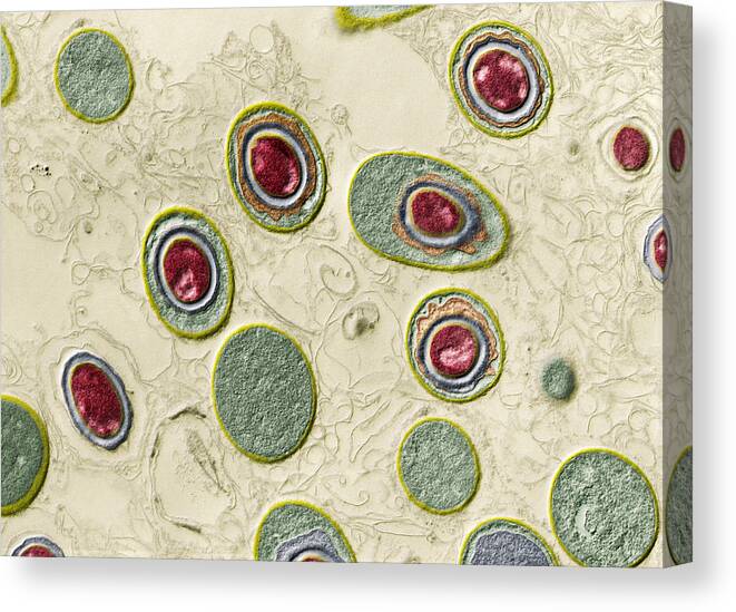 Bacteria Canvas Print featuring the photograph Anthrax Bacteria, Bacillus Anthracis #1 by Eye of Science