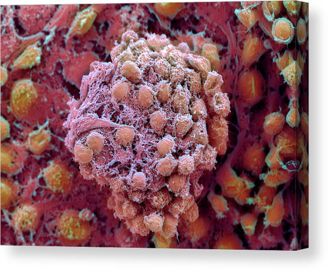 Embryonic Stem Cell Canvas Print featuring the photograph Embryonic Stem Cells #1 by Professor Miodrag Stojkovic/science Photo Library