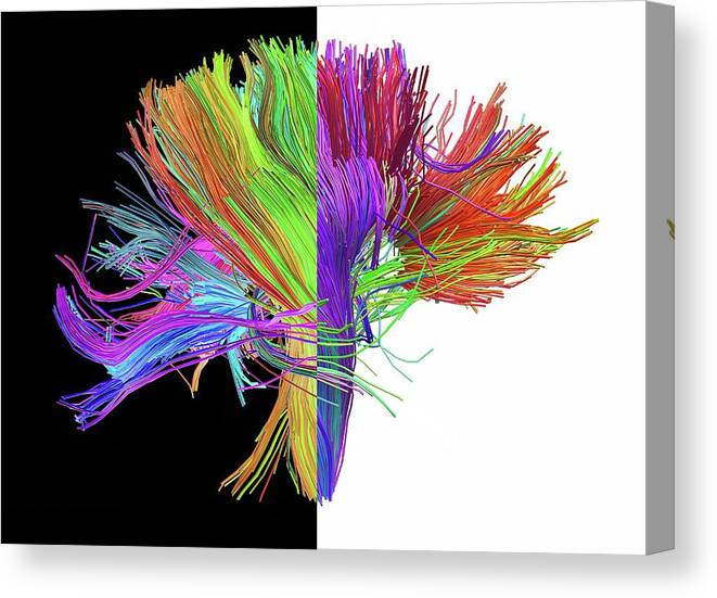 Brain Scan Canvas Print featuring the photograph White Matter Fibres Of The Human Brain #5 by Alfred Pasieka