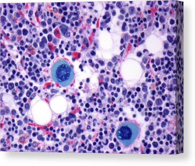 Anatomy Canvas Print featuring the digital art Bone Marrow, Light Micrograph by Science Photo Library - Steve Gschmeissner