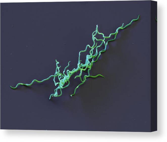 Lyme Disease Canvas Print featuring the photograph Borrelia Bavariensis, Sem by Eye of Science