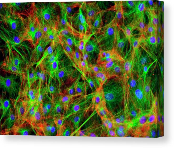 Cell Canvas Print featuring the photograph Osteoblast Cells by Kevin Mackenzie / University Of Aberdeen / Science Photo Library