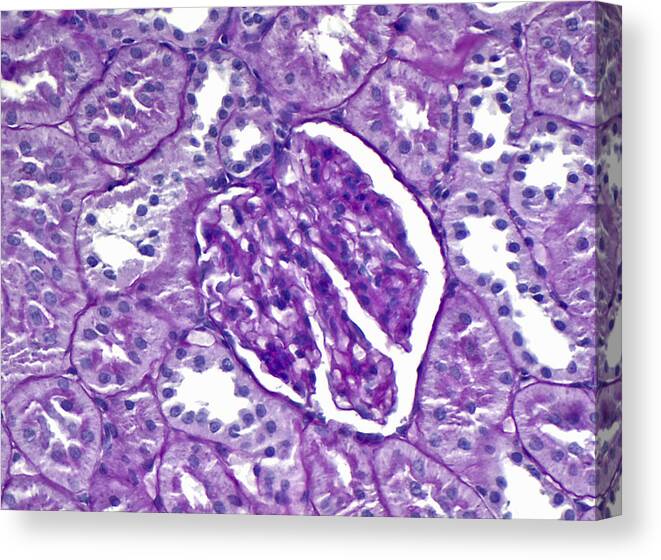Kidney Canvas Print featuring the photograph Renal Cortex Lm by Alvin Telser