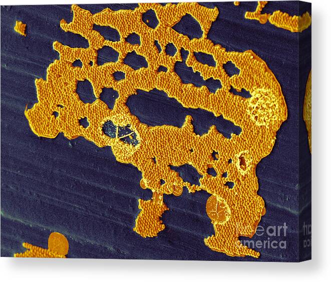Bacterial Biofilm Canvas Print featuring the photograph Bacterial Biofilm by Scimat