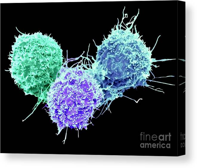 Asbestos Canvas Print featuring the photograph Lung Cancer Cells #6 by Steve Gschmeissner/science Photo Library