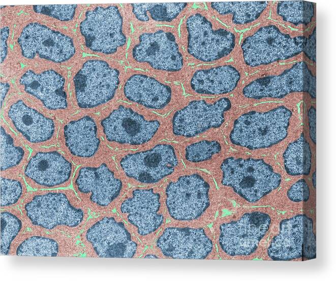 Microscopy Canvas Print featuring the photograph Epithelial Cells by Jose Calvo/science Photo Library