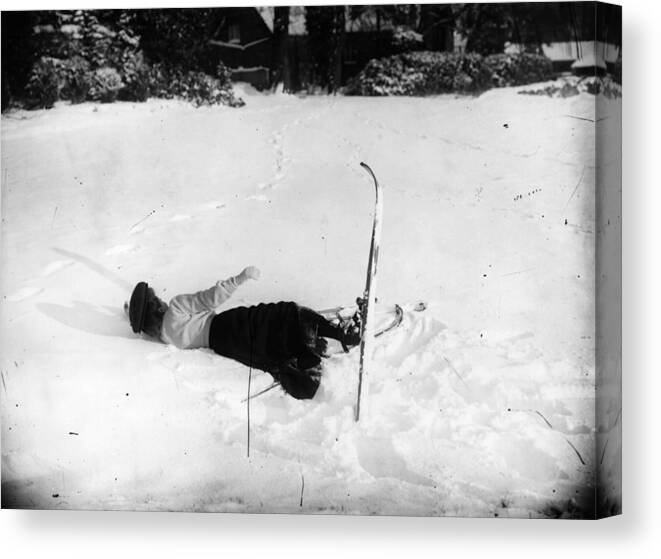 Skiing Canvas Print featuring the photograph Fallen Skier by Topical Press Agency