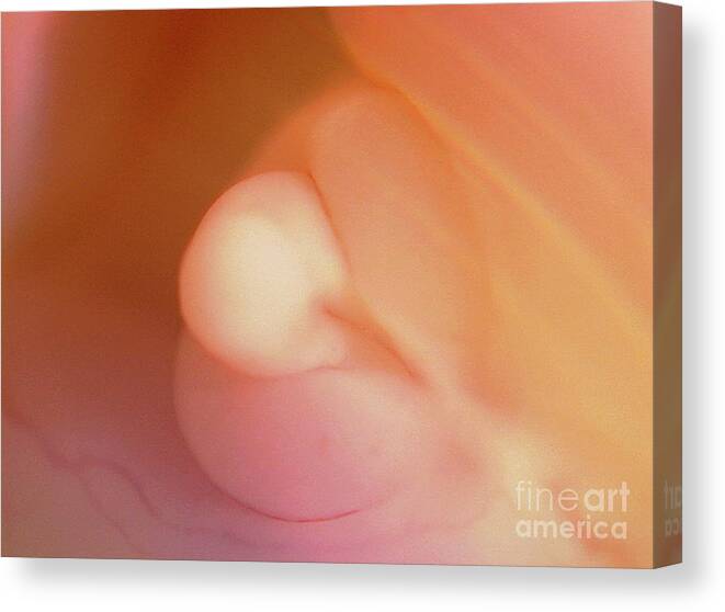 Anatomical Canvas Print featuring the photograph Foetal Development by Thierry Berrod, Mona Lisa Production/science Photo Library