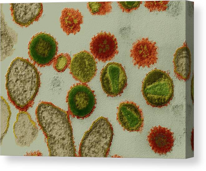 Acquired Immune Deficiency Syndrome Canvas Print featuring the photograph Hiv Viruses by Oliver Meckes EYE OF SCIENCE