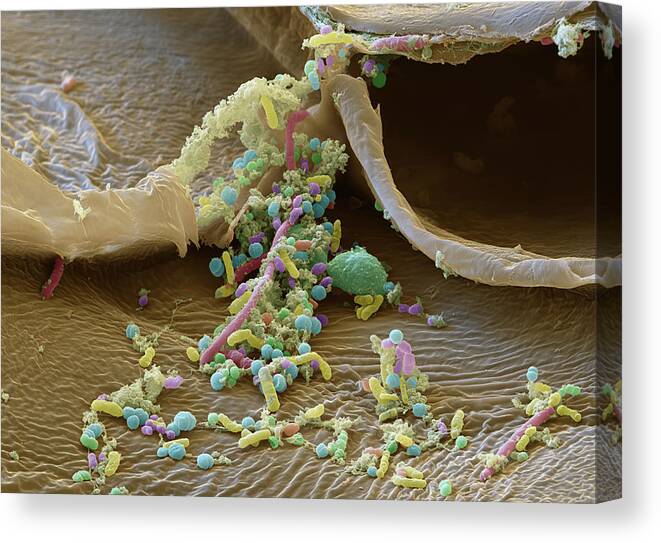 Bacteria Canvas Print featuring the photograph Sauerkraut, Sem by Oliver Meckes EYE OF SCIENCE