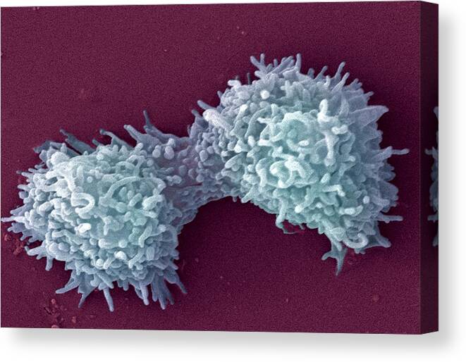 Amoeba Canvas Print featuring the photograph Amoebae #1 by Ami Images/science Photo Library