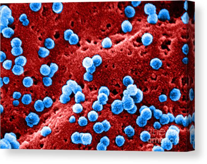 Aids Canvas Print featuring the photograph Human Immunodeficiency Virus #3 by Dr Cecil H Fox