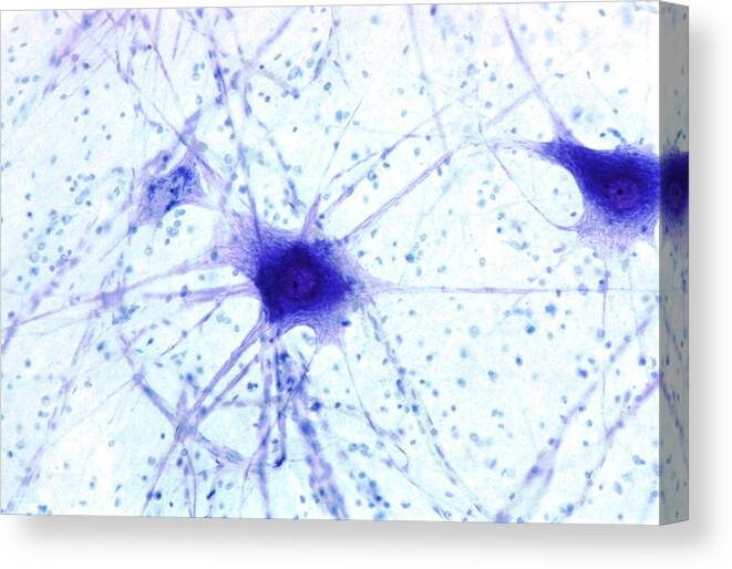 Multipolar Neuron Canvas Print featuring the photograph Nerve Cells #3 by Steve Gschmeissner