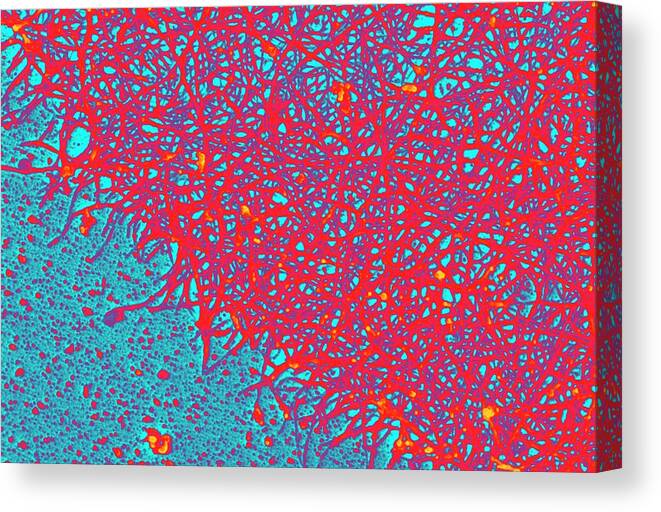 Organelle Canvas Print featuring the photograph Cytoskeleton by Ammrf, University Of Sydney