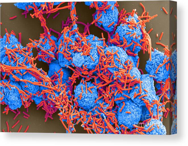 Science Canvas Print featuring the photograph E Coli And Macrophages Sem by Science Source