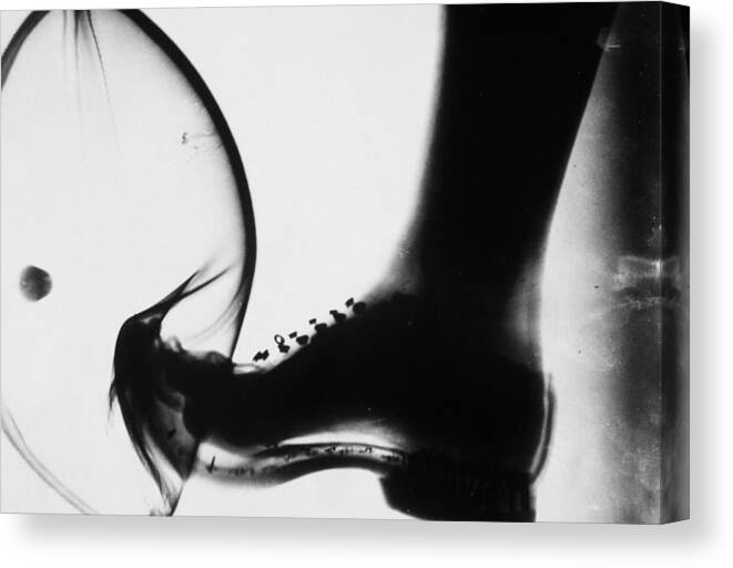 X-ray Canvas Print featuring the photograph Kicking A Ball, X-ray by Omikron