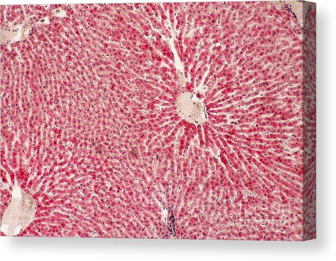 Histology Canvas Print featuring the photograph Liver Lm by Patrick J. Lynch