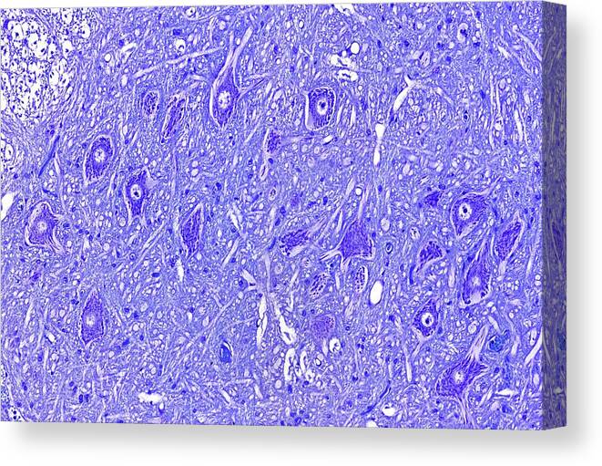 Nerve Canvas Print featuring the photograph Motor Neurons by Microscape