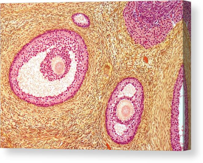 Horizontal Canvas Print featuring the digital art Ovarian Follicles, Light Micrograph #4 by Steve Gschmeissner