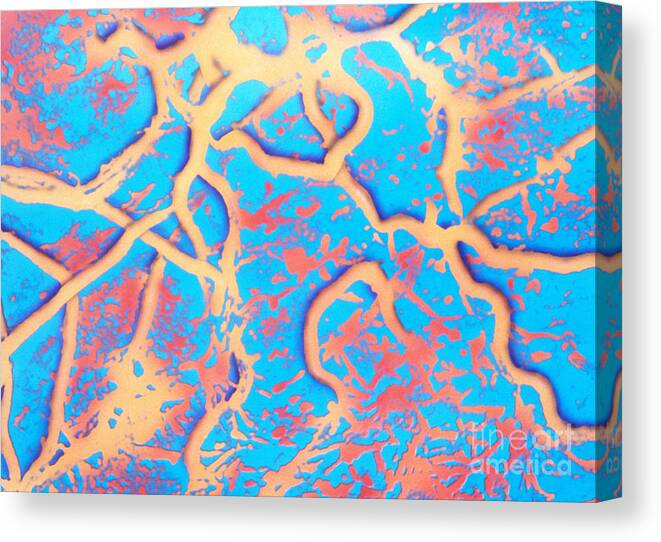 Micrograph Canvas Print featuring the photograph Borrelia Burgdorferi #5 by Science Source