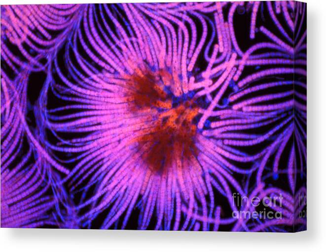 Light Microscopy Canvas Print featuring the photograph Gleotrichia by M. I. Walker
