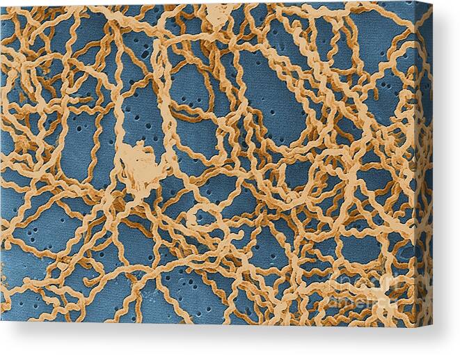 Spirochete Canvas Print featuring the photograph Leptospira by Science Source